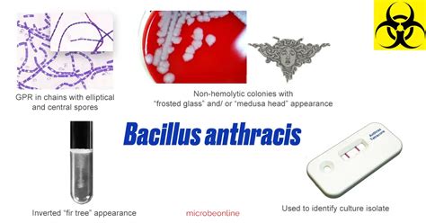 Bacillus anthracis: Properties, Pathogenesis, Lab Diagnosis • Microbe ...