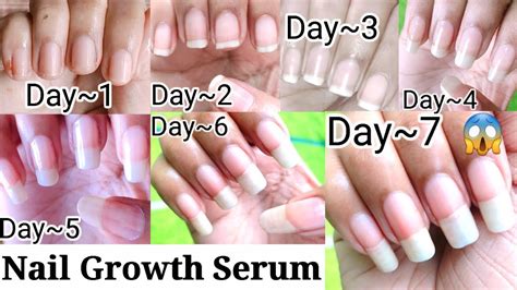 Bitten Nails Growth - YouTube