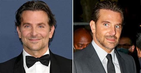 Bradley Cooper's Shocking New Face, Plastic Surgeons Weigh In