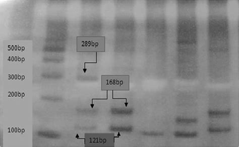 Acrylamide gel electrophoresis. | Download Scientific Diagram