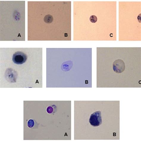 Production of reticulocytes from HSCs, morphologic analysis after... | Download Scientific Diagram