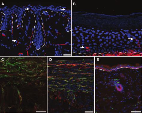 Addition of Schwann cells and hair buds to improve nerve regeneration... | Download Scientific ...