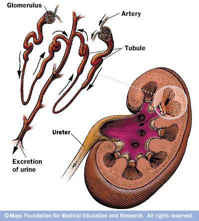 Glomerulonephritis » Division of Nephrology, Hypertension & Renal ...