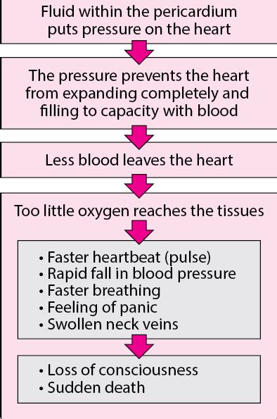 Cardiac Tamponade Symptoms