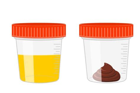 How to Test for Occult Blood in Stool? – healthcare nt sickcare