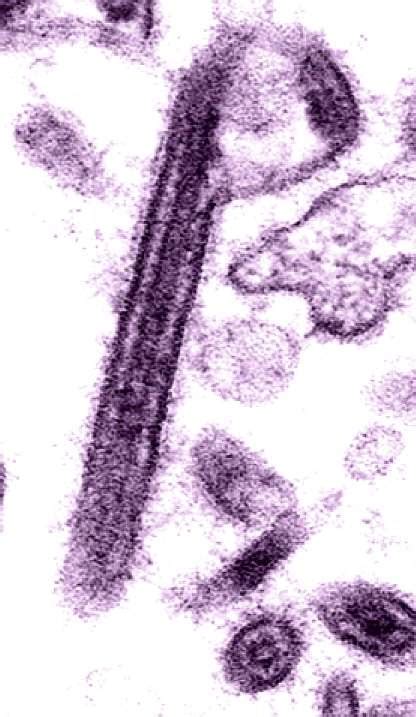 Free picture: ebola, pathogen, member, filoviridae, family, viruses