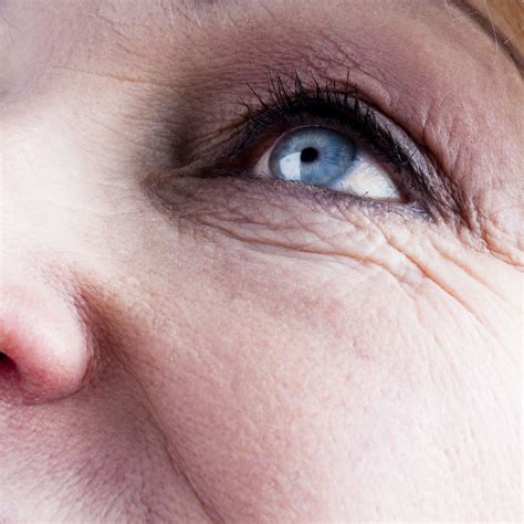 5 Types of Wrinkles and How to Tackle Each One - NewBeauty