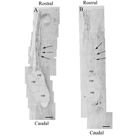 Photomicrograph montages of rubrospinal tract axons labeled by BDA... | Download Scientific Diagram