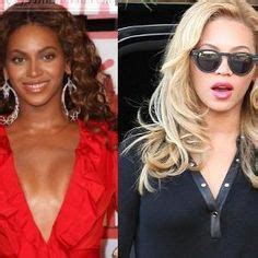 15 Skin Bleach Before & After ideas | skin bleaching, beyonce skin, skin