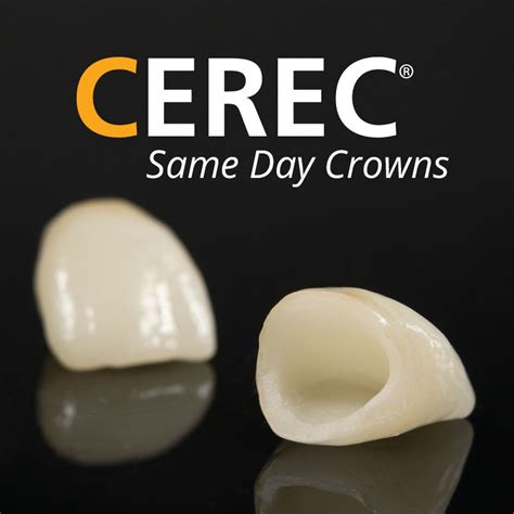 CEREC Same-day Dental Crowns - Mountain View, CA