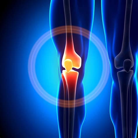 Knee Pain Treatment | Knee Surgeon FloridaOrthoCare Surgeon