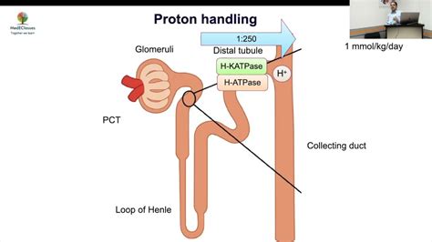 RTA Pathophysiology - YouTube