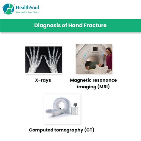 Hand Fracture: Symptoms and Treatment – Healthsoul