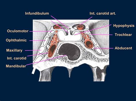 Cavernous sinus