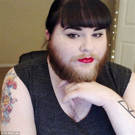 Woman With PCOS Grows A Full Beard After Finding Love With A Model