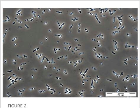 Figure 2 from A review on poly(3-hydroxybutyrate-co-3-hydroxyhexanoate ...