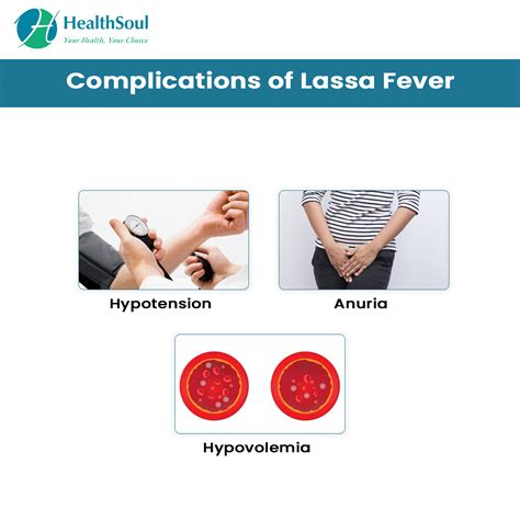 Lassa Fever: Symptoms and Treatment – Healthsoul