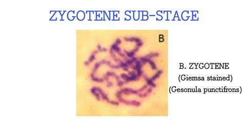 Zygotene sub-stage of Prophase 1, Grasshopper (Gesonula punctifrons) testes - YouTube