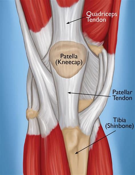 Quadriceps and Patellar Tendon Tear: Causes and Symptoms