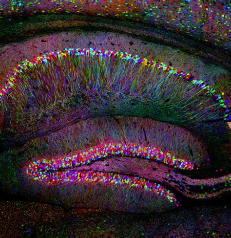 Brainbow - A mouse hippocampus where individual neurons express a random colour, it's gorgeous ...