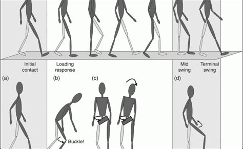 Normal Gait And Common Gait Abnormalities – Otosection