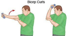 Elbow Bursitis Exercises - What You Need to Know