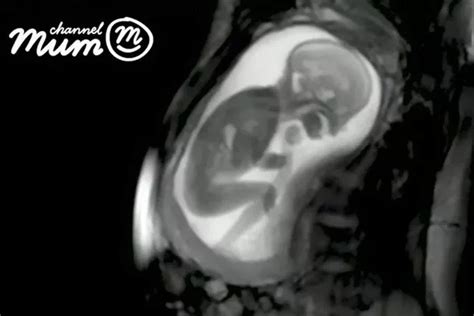 Incredible MRI scan shows baby kicking, smiling and dancing in the womb ...