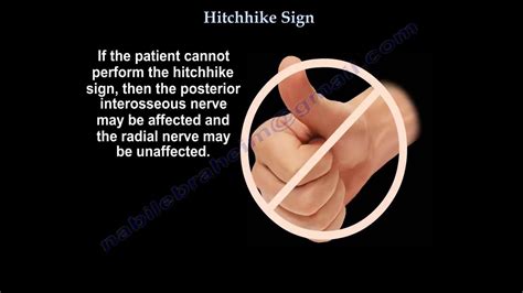 Hitchhike Sign, Thumb - Everything You Need To Know - Dr. Nabil ...