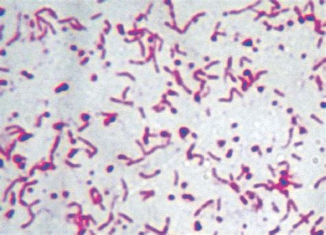 Corynebacterium Gram Stain