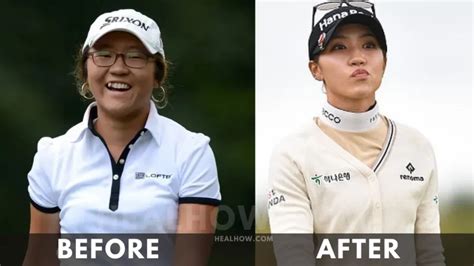 Lydia Ko Weight Loss 2024: Before and After