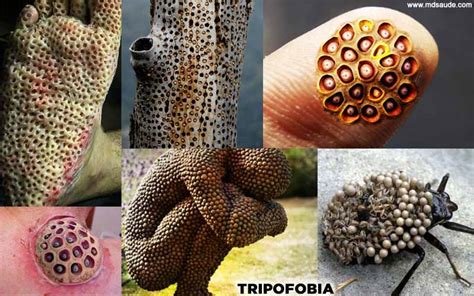 TRIPOFOBIA [com imagens]: o que é a fobia de buracos?