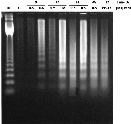 Detection of DNA fragmentation by agarose gel electrophoresis. PC12... | Download Scientific Diagram