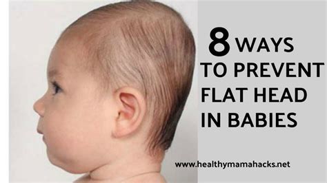 What is Plagiocephaly? 8 Tips to Prevent “Flat Head Syndrome” in Babies ...