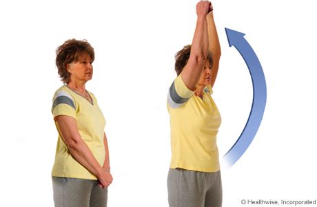 Mastectomy: Exercise After Mastectomy