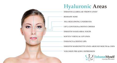 Cost of Hyaluronic Acid Dermal Fillers - Types, Benefits, Results