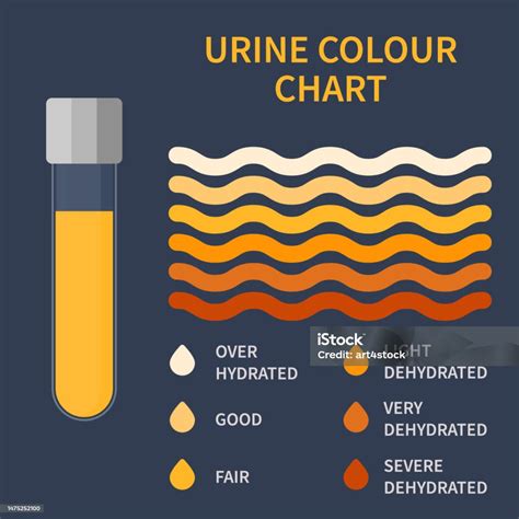 Urine Color Chart Illustration Of Dehydration Level Stock Illustration ...