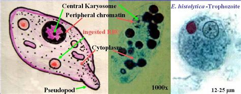 Entamoeba histolytica trophozoite | Medical Laboratories