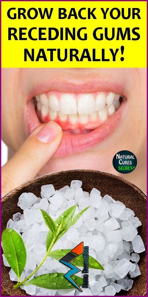 How To Treat Receding Gums at Home - Home Remedies for Gum Disease How To Treat Receding Gums at ...