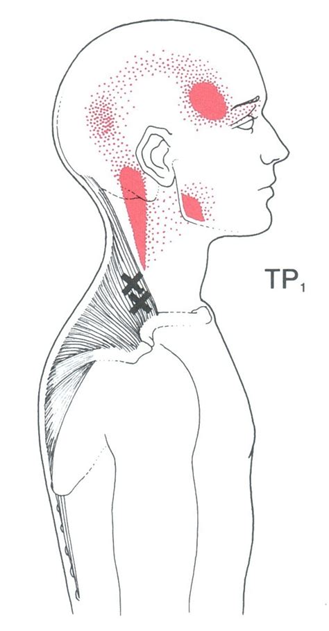 Pin on Physio-topia