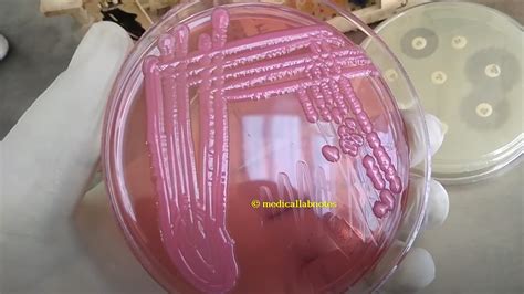 Enterobacter cloacae: Introduction, Identification Features, Key