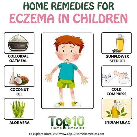 Natural Remedies for Eczema in Children | Home remedies for eczema, Eczema remedies, Eczema kids