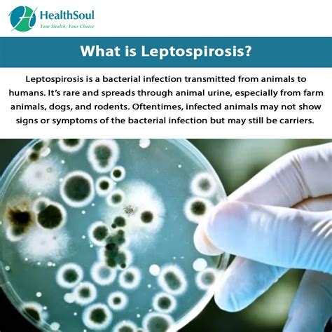 Leptospirosis: Symptoms and Treatment – Healthsoul