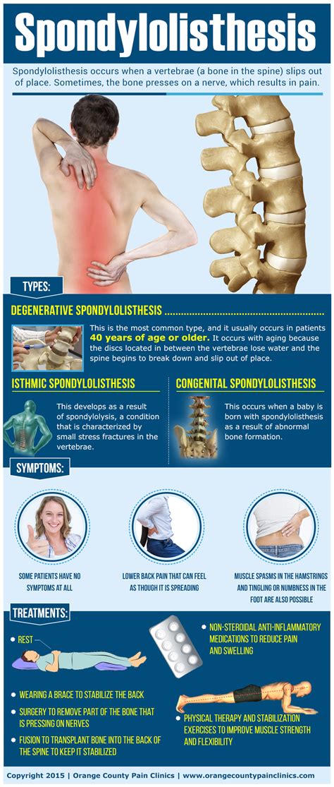 Spondylolisthesis - Orange County Pain Clinics