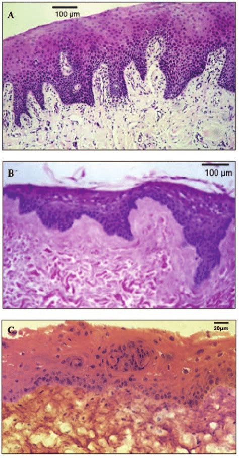 Buccal Mucosa Histology