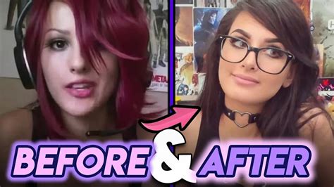 Sssniperwolf | Before and After | Plastic Surgery Rumours & Transformation