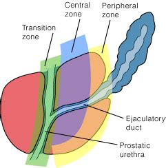 Prostate Cancer Awareness | The Healthy Answer Help