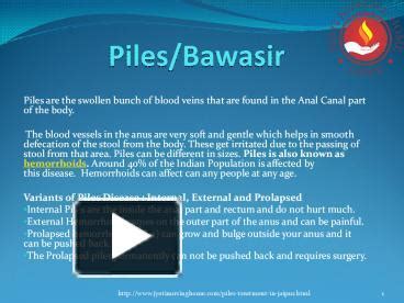 PPT – Piles/bawasir: symptoms, causes and treatments – jyotinursinghome PowerPoint presentation ...