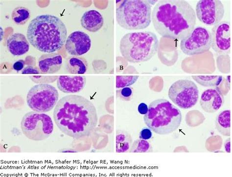 Mitotic Figures | Oncohema Key