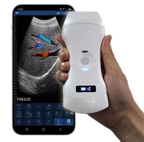 Ultrasound – Edge Life Technologies - The Leading Innovators In Ultrasound Ultrasound