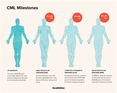 Chronic Myeloid Leukemia (CML) Treatment Milestones